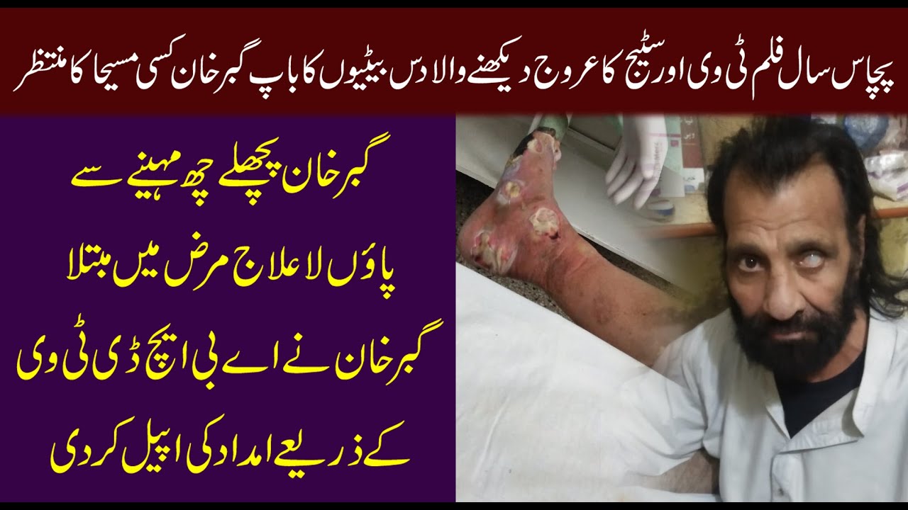 Pakistani Gabbar Requested People To Help Him || Babar Baig Gujrati || Gabbar || KhidmatEInsaniyat
