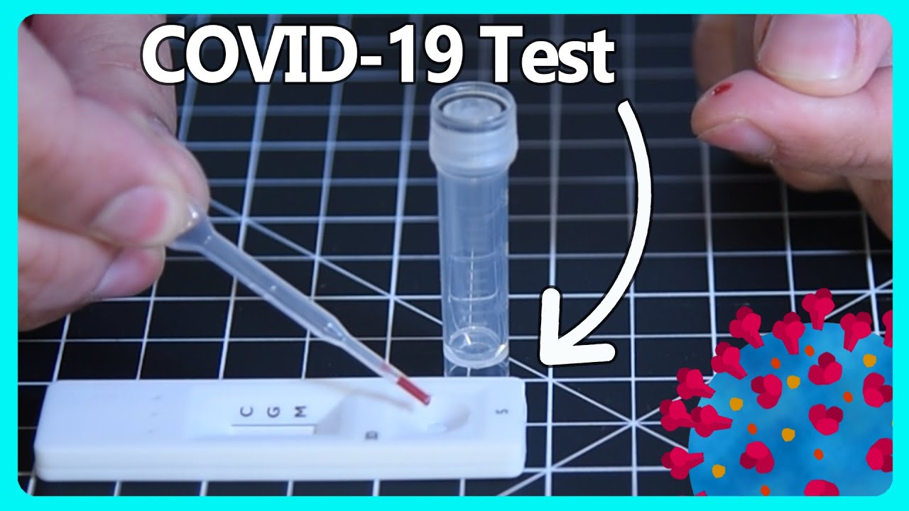 Как на самом деле работает тестирование на COVID-19?