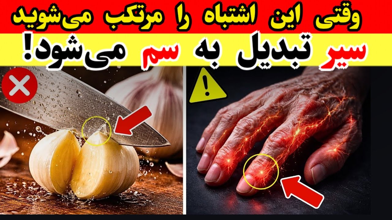  هرگز سیر را با این ۵ غذا نخورید - می‌تواند باعث مشکلات جدی برای سلامتی شود.سمی و سرطانزا