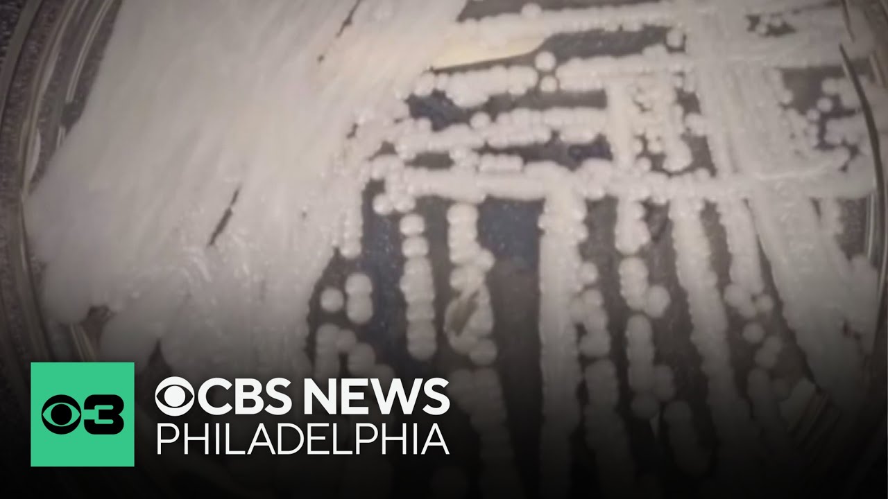 Dangerous fungus spreading across hospitals, nursing homes nationwide, CDC reports