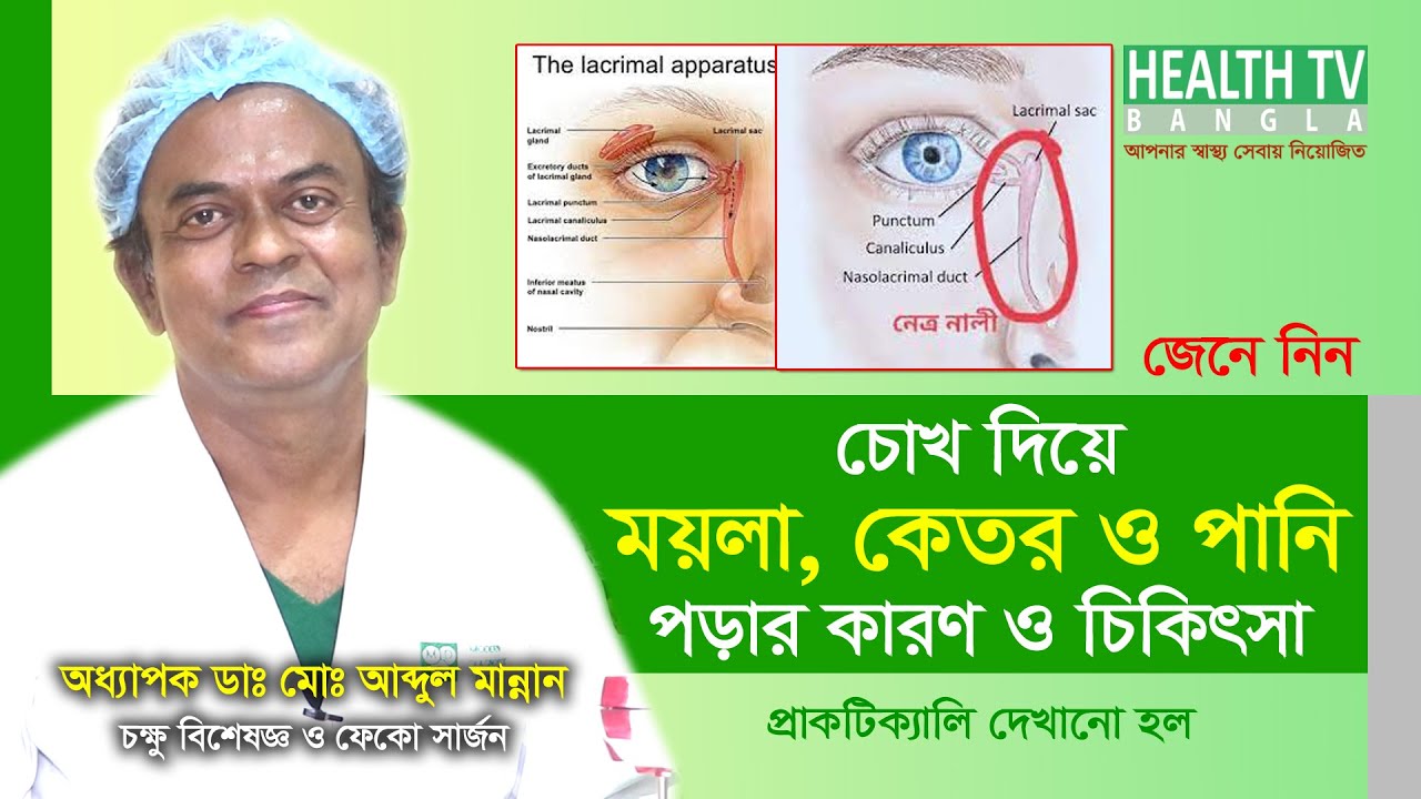 চোখ দিয়ে ময়লা, কেতর ও পানি পড়ার কারণ এবং প্রতিকার | Prof. Dr. Abdul Mannan-Eye Specialist