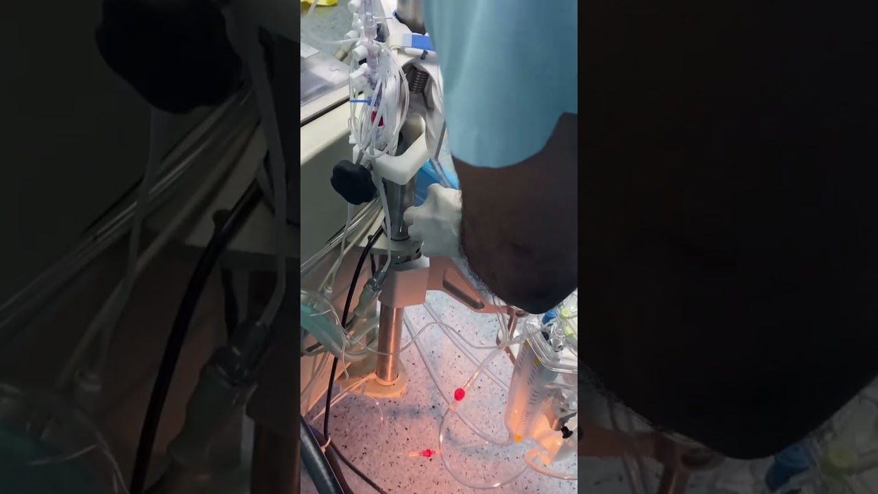 Assembling the pump|Heart operation |BabyRx Neonatal pump assembling |cardiacsurgery