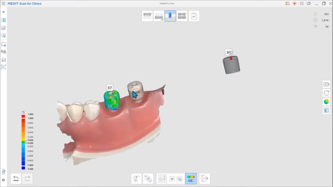 AI Scan Body Matching (ENG)