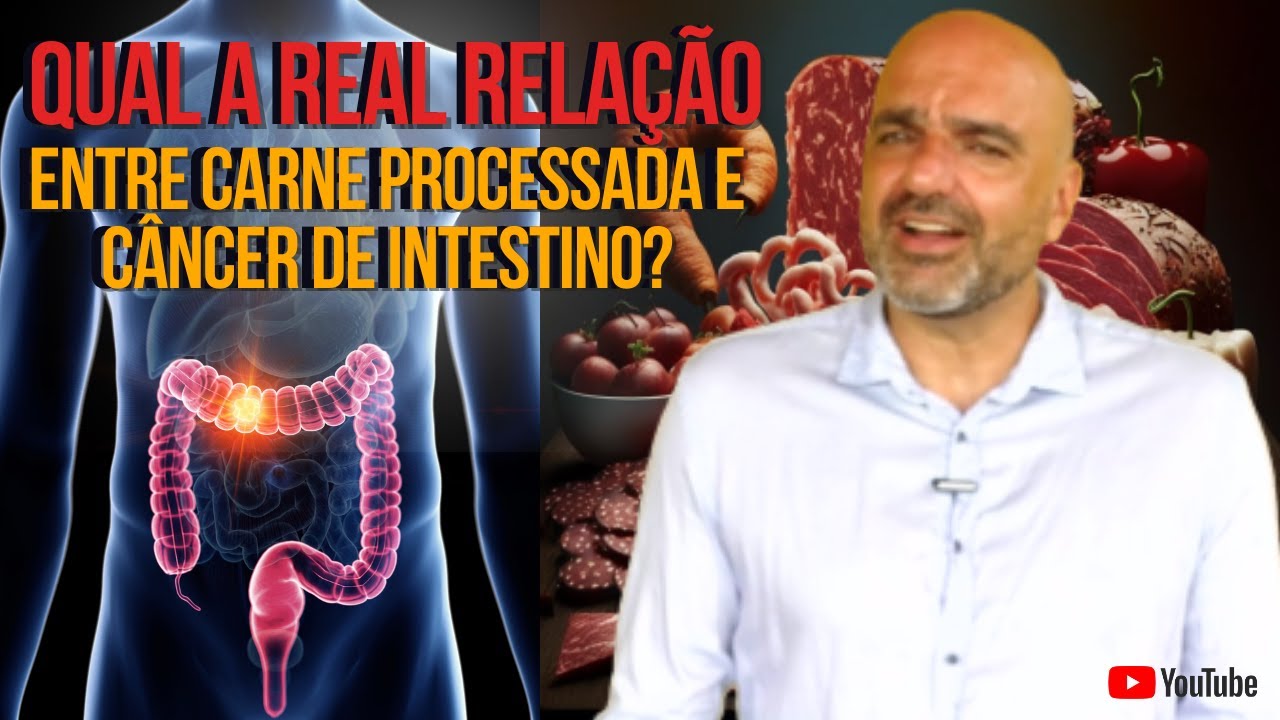 Câncer de Intestino X Presunto, mortadela, salame, bacon - Qual a relação?