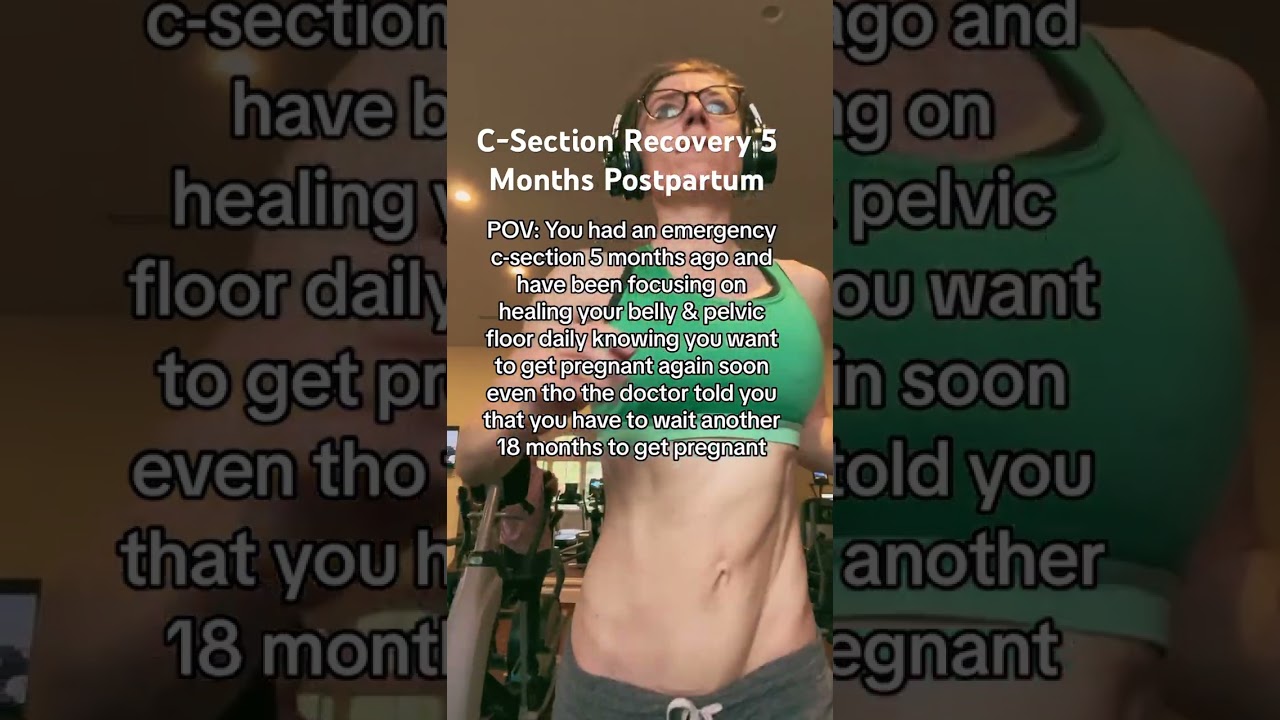 C-Section Recovery 5 Months Postpartum 