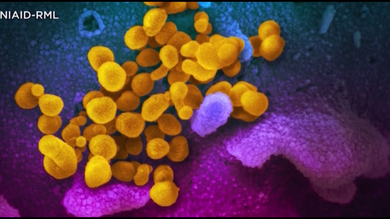 Local school systems are paying attention to the coronavirus threat