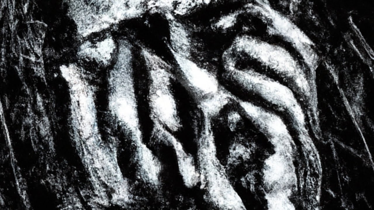A Truly Devastating Account of Stimulant Psychosis