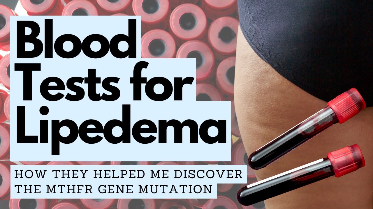 Medical Testing for Lipedema: How Blood Tests Helped Me Discover the MTHFR Gene Mutation
