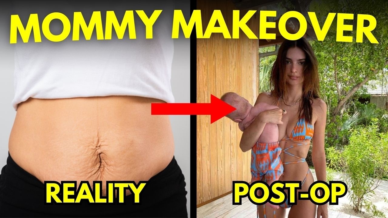 Dream Body Secrets Moms are using in 2024! Brazilian Butt Lift