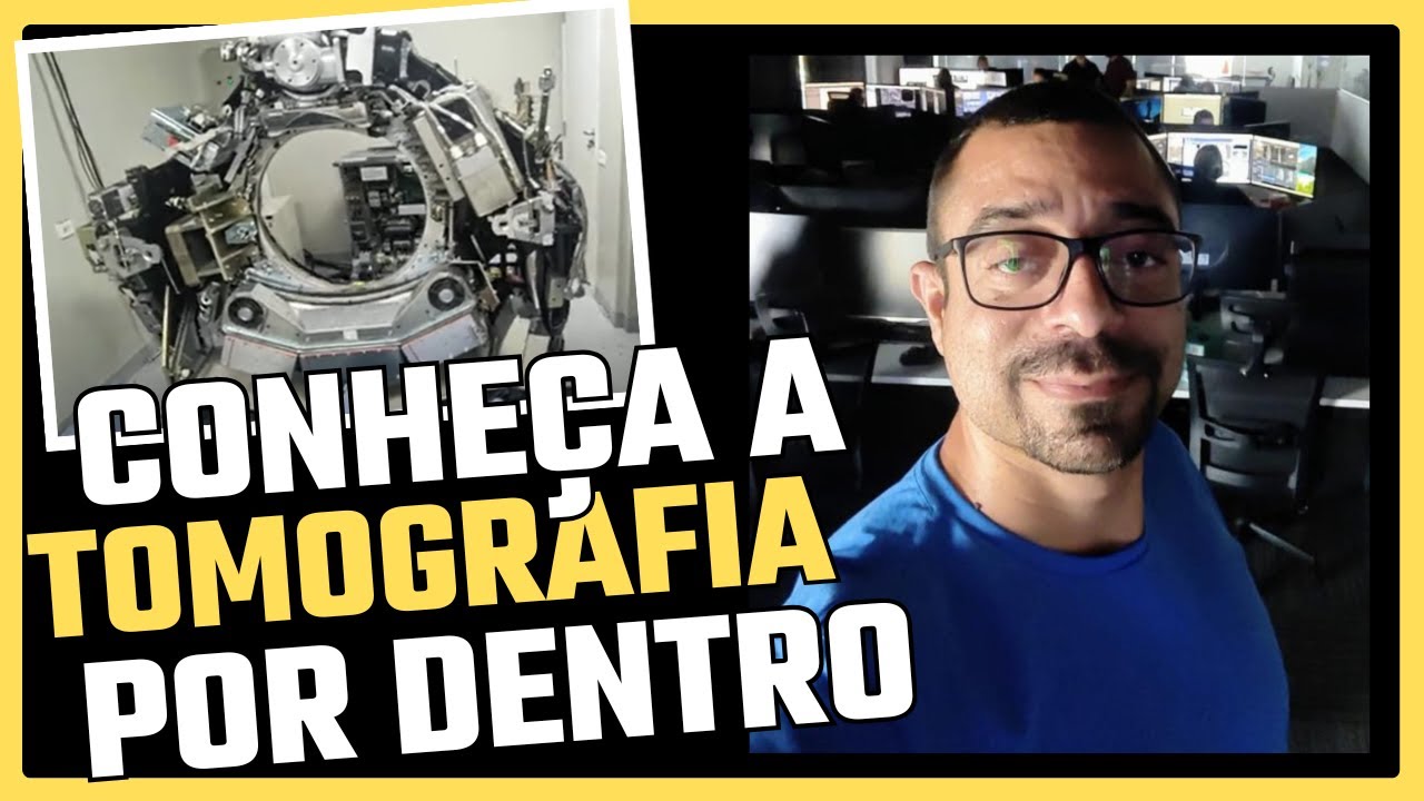 Conheça a Tomografia por Dentro | Herick Savione