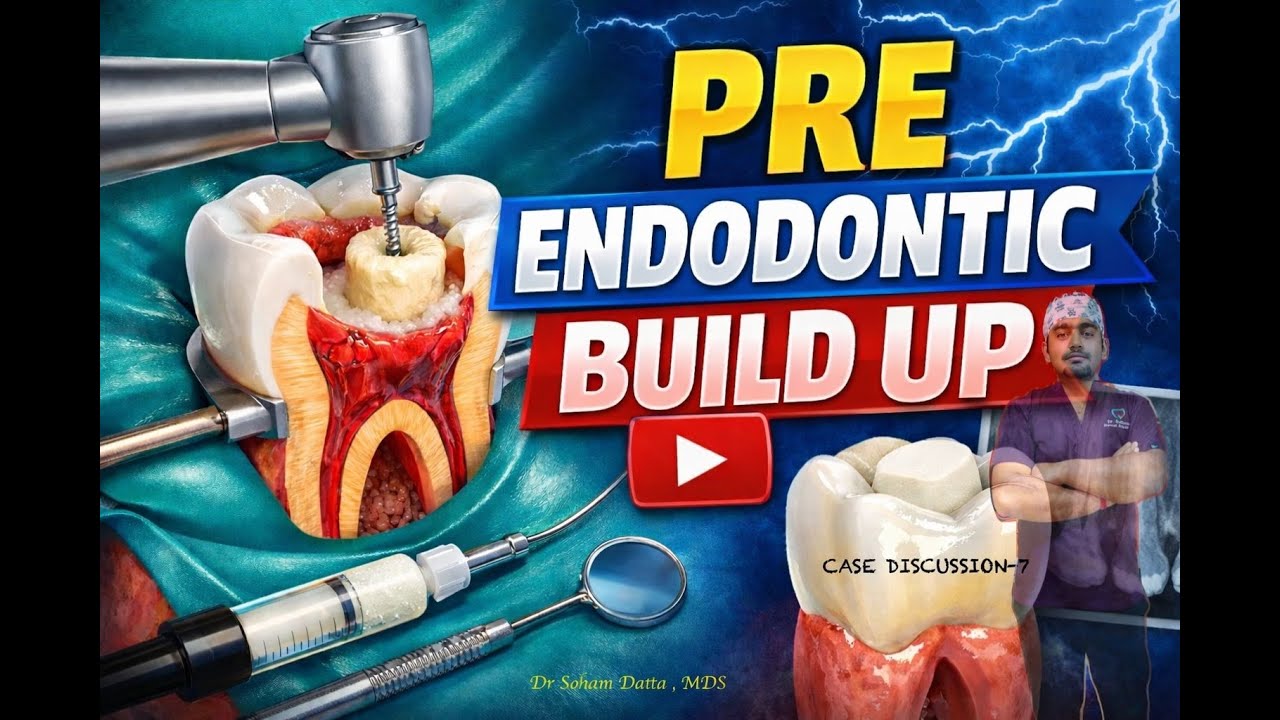 Pre-Endodontic Build Up - Provisional Technique (Case Discussion -7) 🔥 