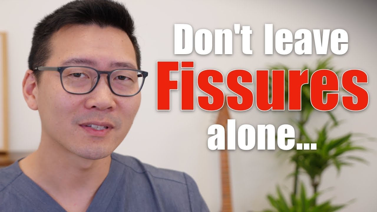 Don't Leave Anal Fissures Alone!