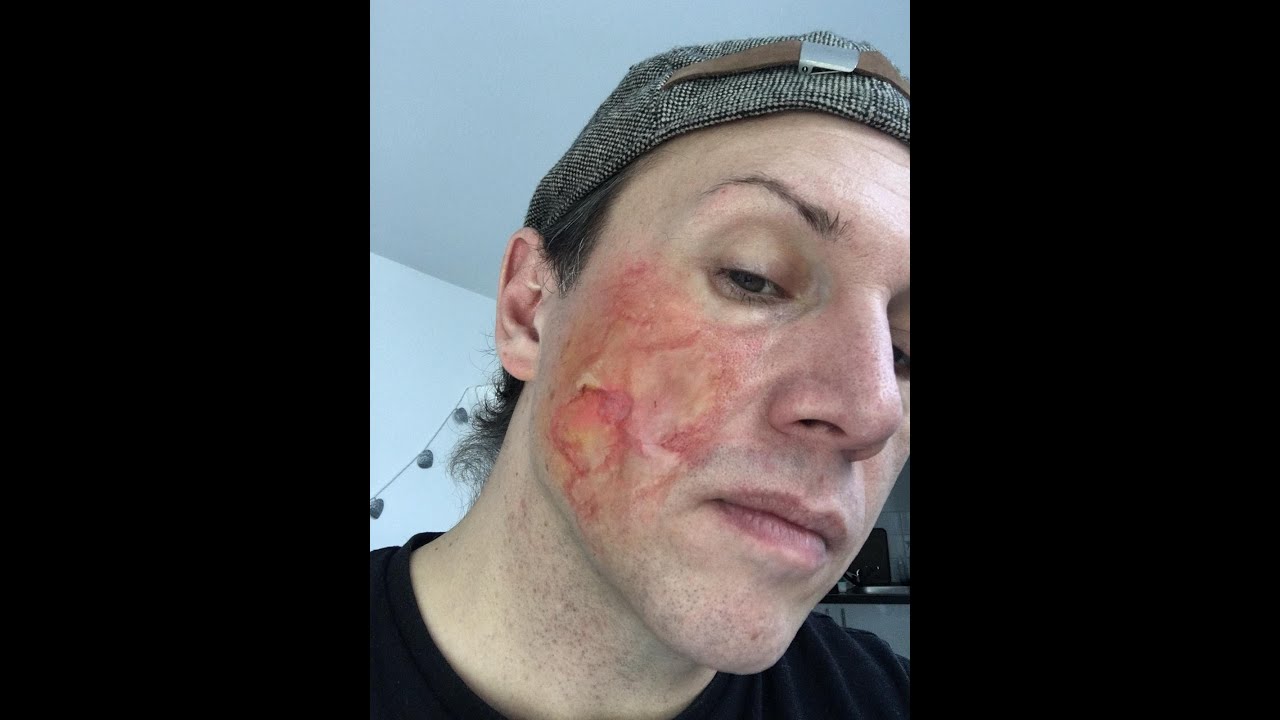 Acid Burn, 2nd Degree, Sculpt Gel - SFX Makeup - Out of Kit Demo - 2020 Lockdown Series