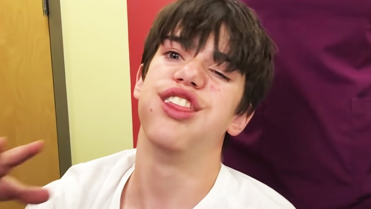 Funniest Wisdom Teeth Video EVER! Did I actually say that?!