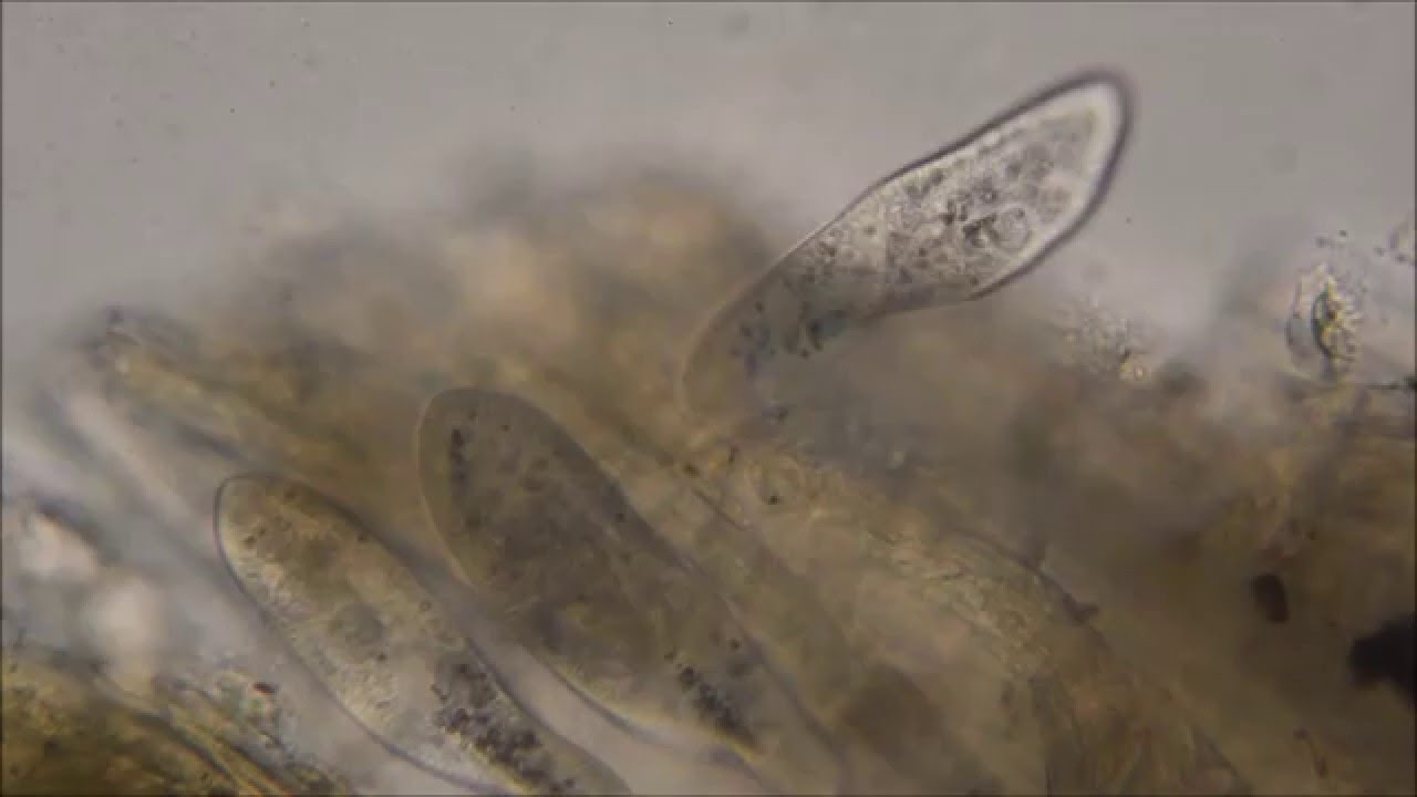 Paramecium caudatum under the microscope