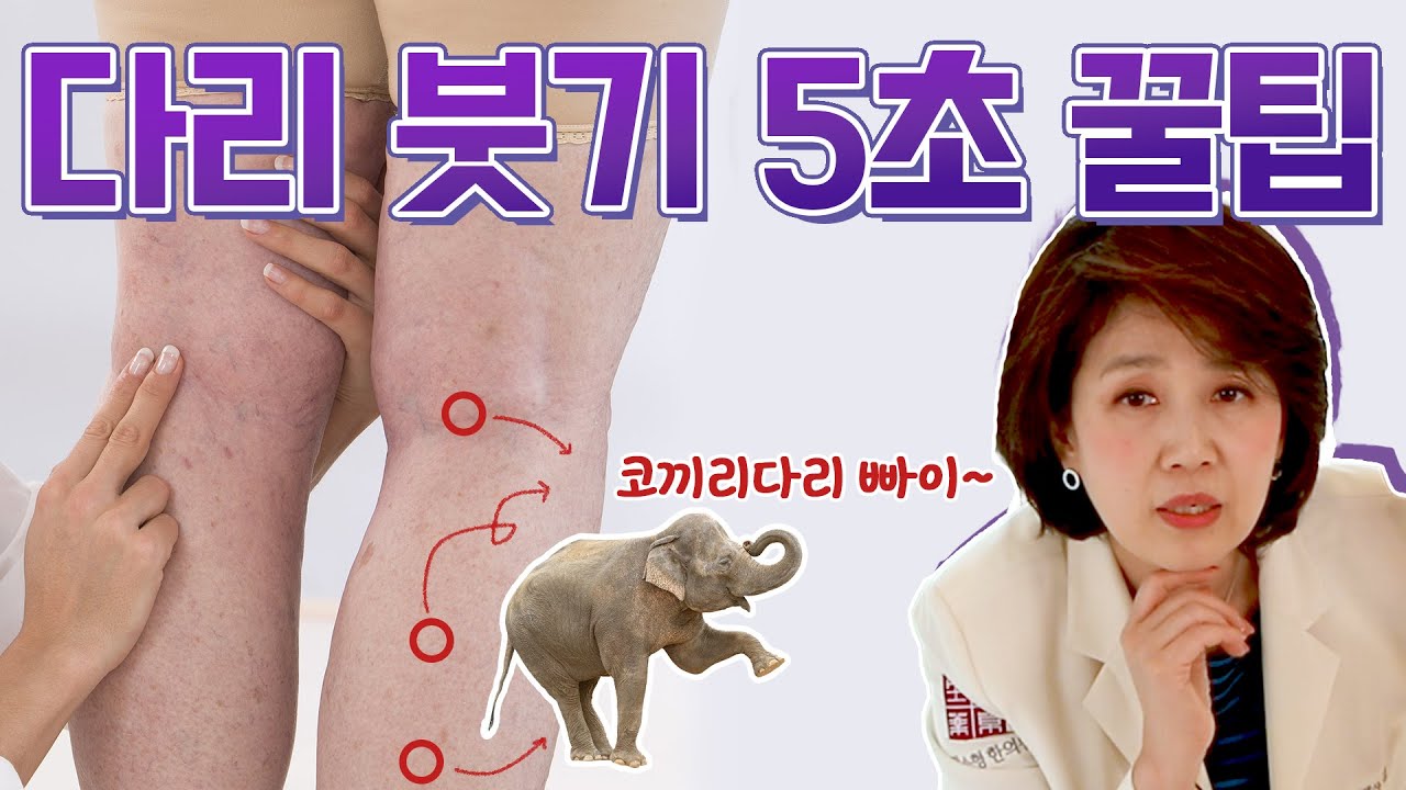 다리 붓기 없애는 5초 꿀팁! 여기만 꾹꾹 눌러주면 코끼리 다리 빠이빠이~