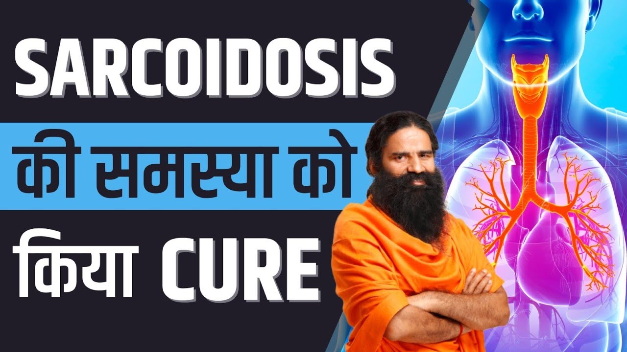 सारकोडाइसिस (Sarcoidosis) की समस्या को किया क्योर  || Swami Ramdev