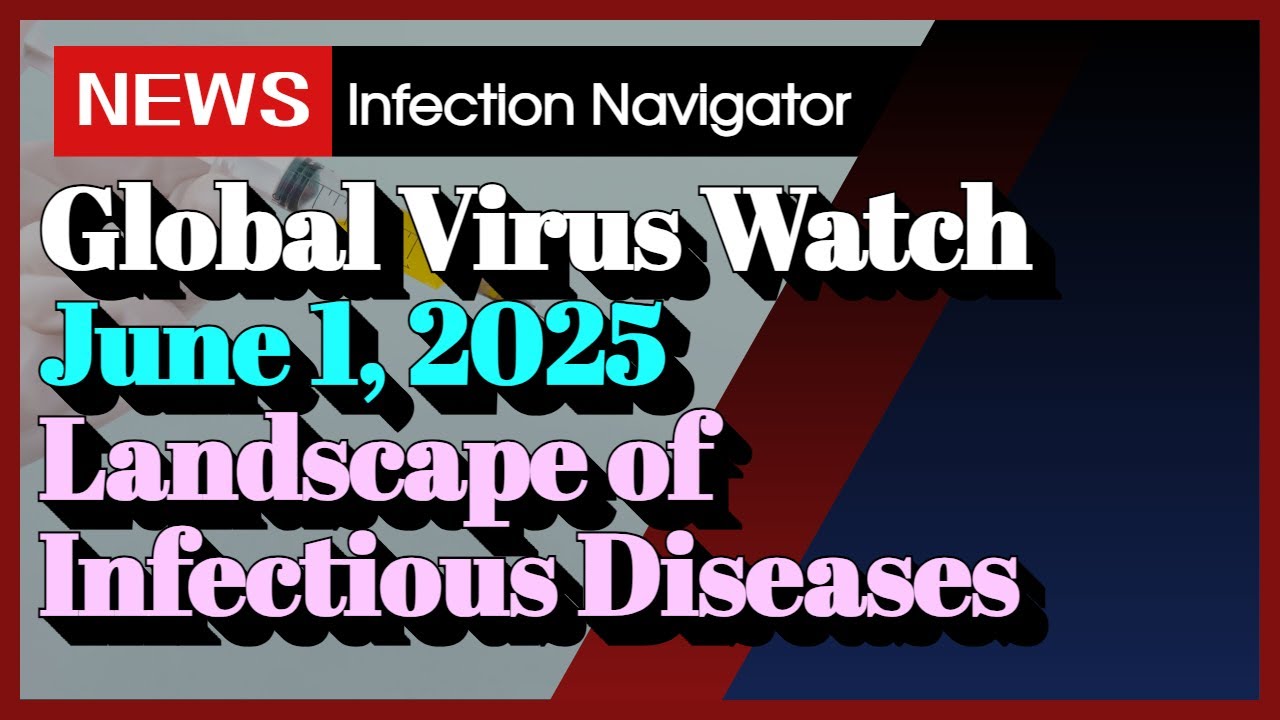 [NEWS] Global Virus Watch June 1, 2025 Landscape of Infectious Diseases