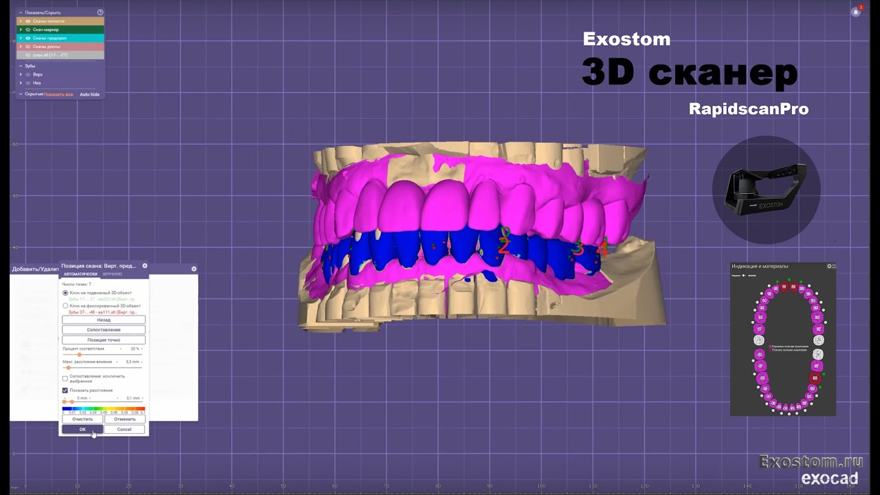 Цифровая стоматология, тотальная работа на лабораторном 3D сканере