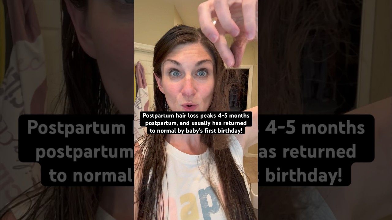 Postpartum hair loss is wild #shorts #pregnancy #postpartum