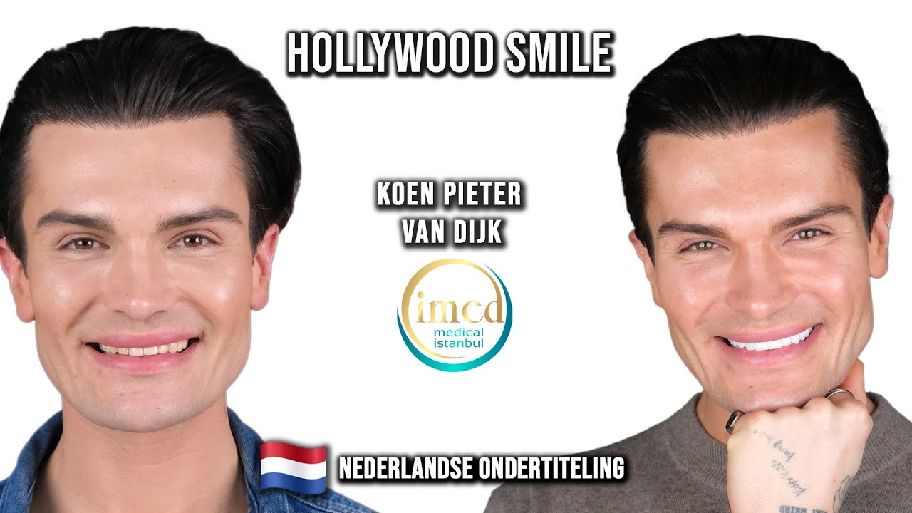 Koen's verhaal: de overstap van veneers naar kronen bij iMed Medical