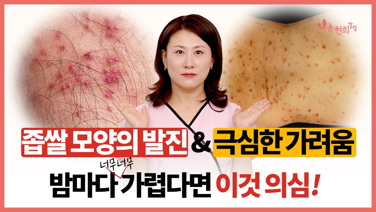 옴? 양진? 피부 가려움 감별법 주의사항✔️ ft. Burrow Ink Test, 발생 부위, 시간