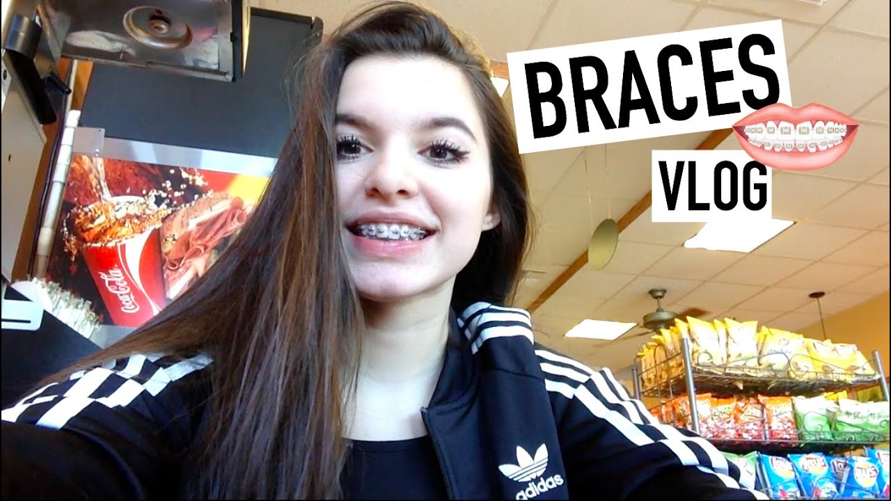 Getting Braces On Vlog