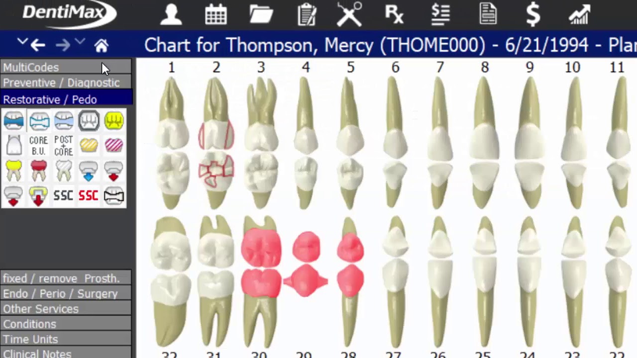 Clinical Charting & Note Click Through | DentiMax 18 Features