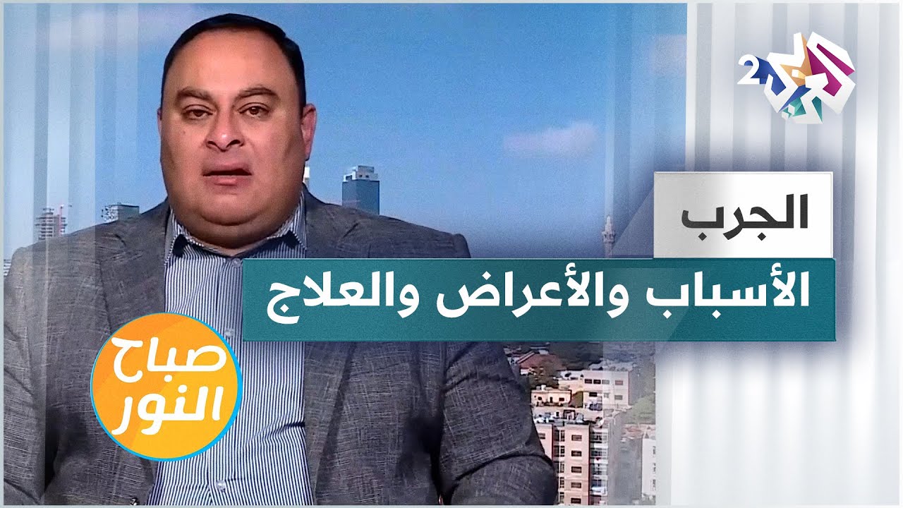 الجرب.. الأسباب والأعراض والعلاج | هل خرج عن السيطرة في الأردن؟