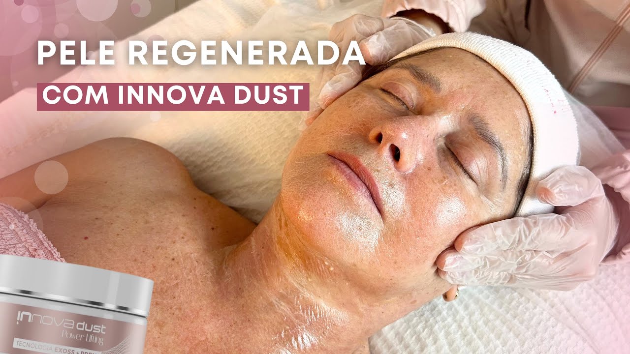 Protocolo Facial Regenerativo em Pele Madura