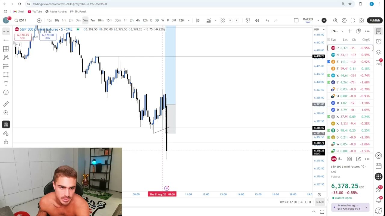 Live Day Trading Making $153,775 (I RISKED 100K)