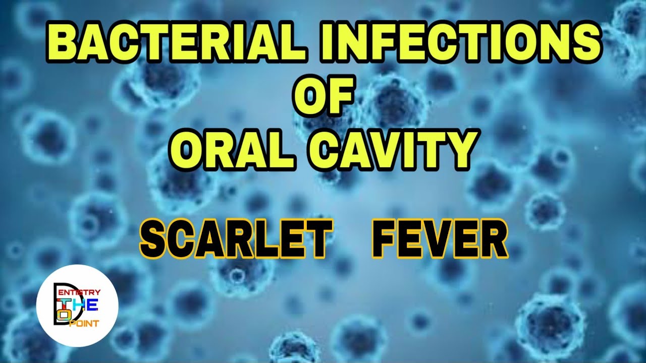 BACTERIAL INFECTIONS OF ORAL CAVITY - SCARLET FEVER