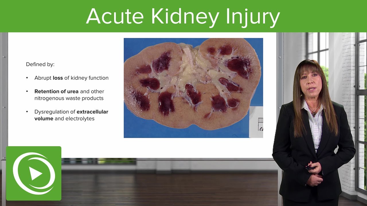 Acute Kidney Injury (AKI): Staging and Etiology – Nephrology  | Lecturio