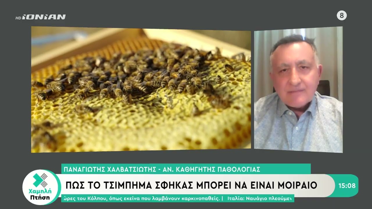 Από αλλεργικό σοκ ο θάνατος του 46χρονου από την Ερμιονίδα