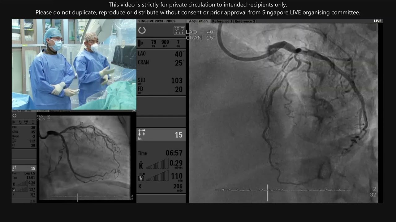 Bifurcation   Singapore LIVE 2023