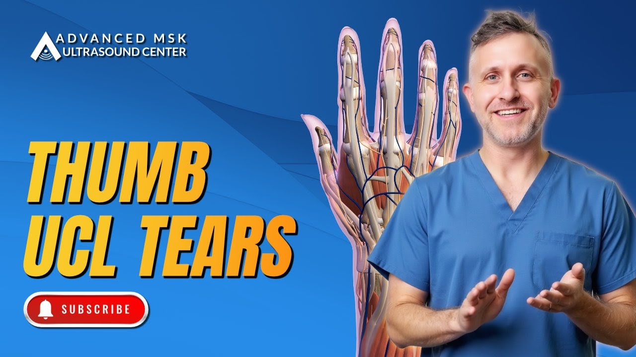Thumb UCL & Stener Lesion: Ultrasound Secrets for Hand Surgery Leaders