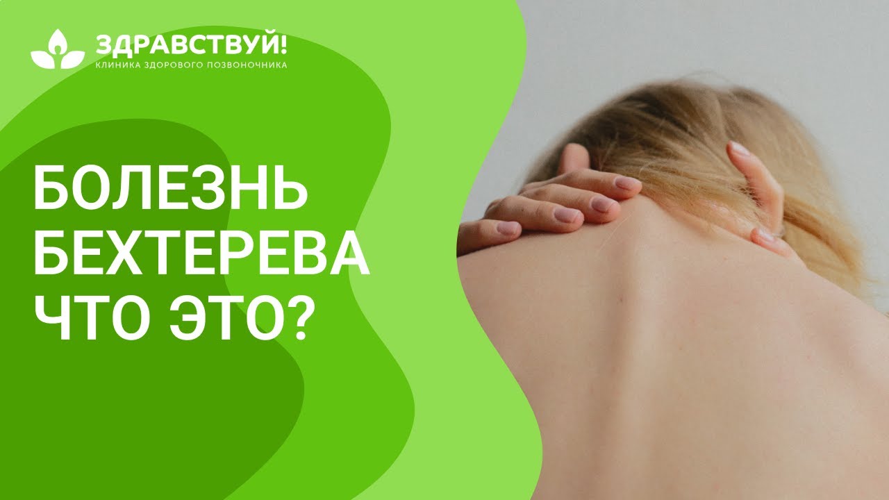 Анкилозирующий спондилоартрит или болезнь Бехтерева