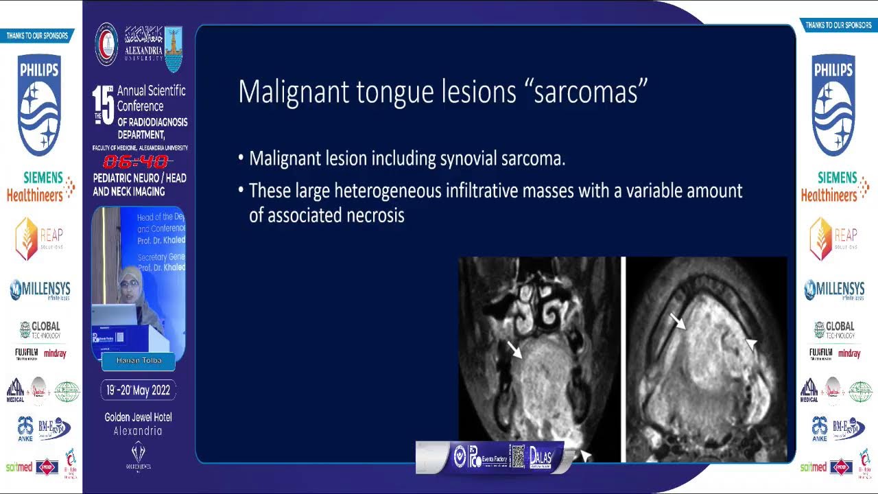 Pediatric Tongue Imaging