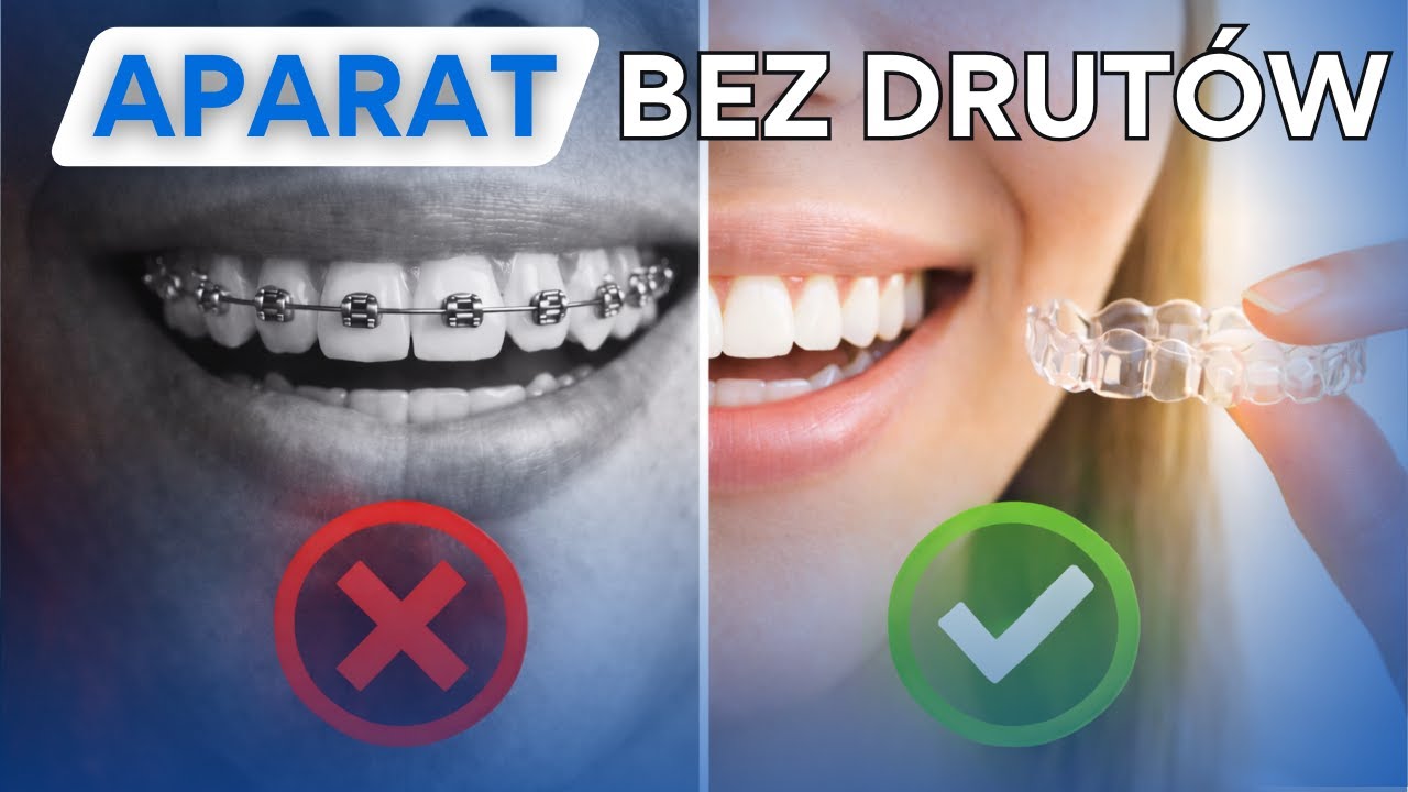 Braces or Invisalign? Reasons to choose aligners