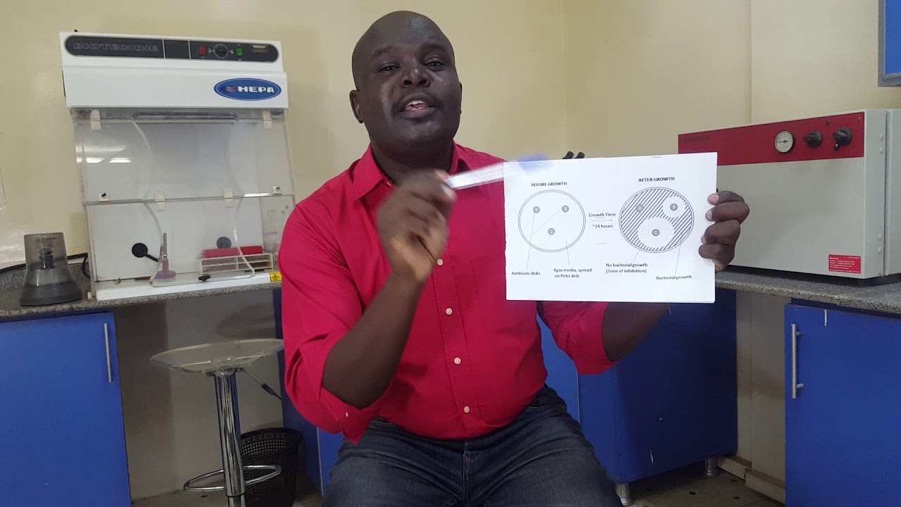 Antibiotic Sensitivity Test إختبار الحساسية للمضادات الحيوية