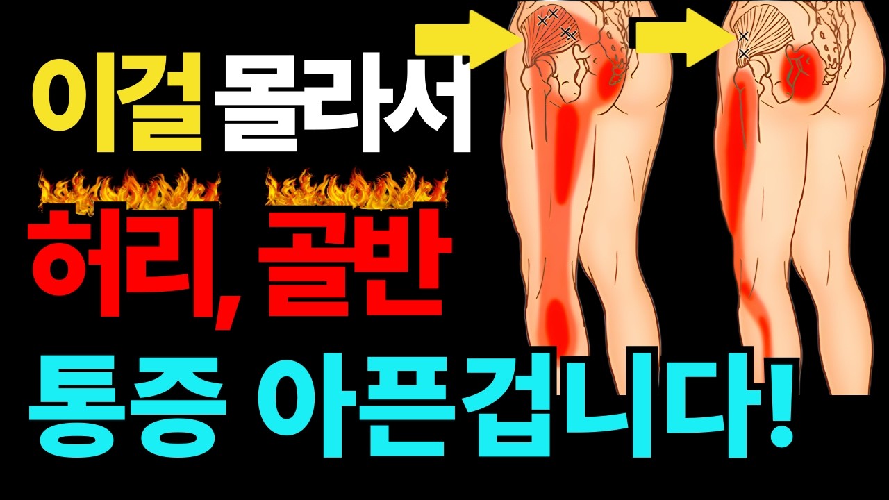 병원 망하게 할 각오로 공개합니다. 허리 통증은 사실 '이것' 하나면 끝납니다