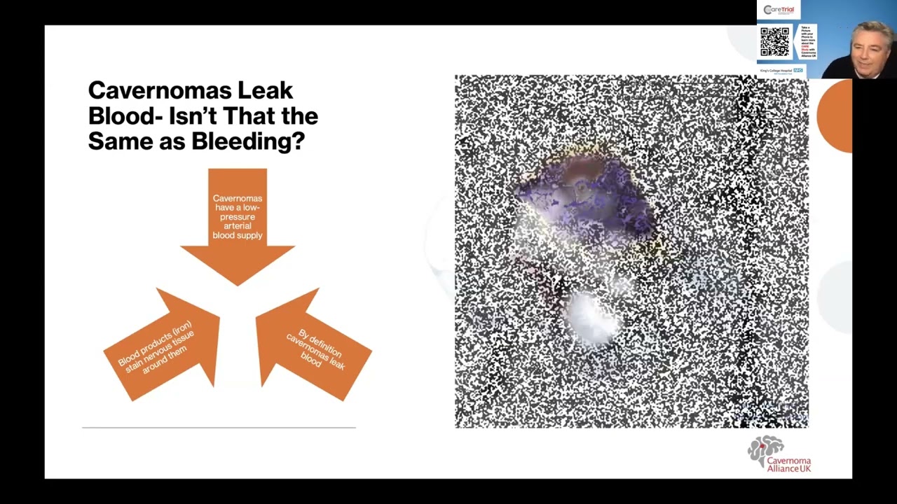 Let's Talk Cavernoma - Bleeding and Stroke Explained