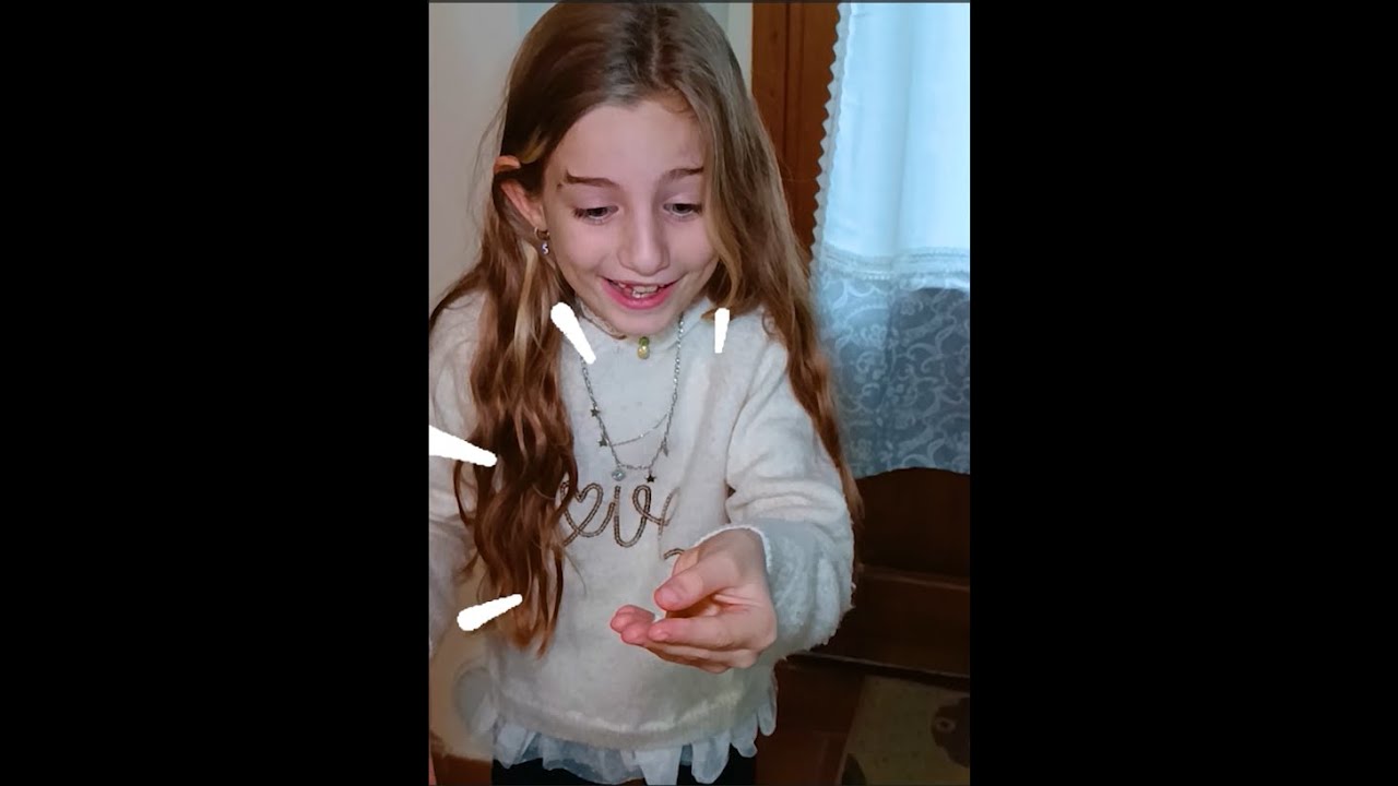 SOFI SI STACCA IL DENTE DA SOLA E SI FA MALE E ESCE TANTO SANGUE! #shorts