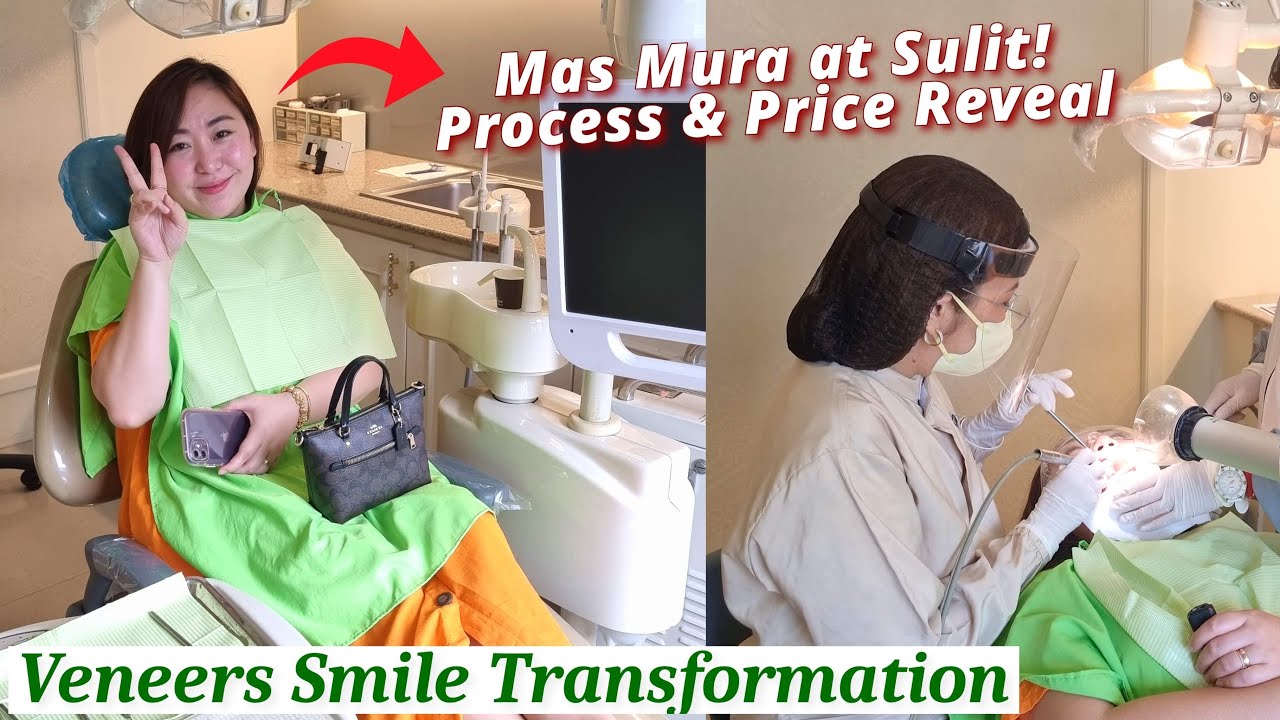 PRICE REVEAL! Mas Mura at Sulit | Veneers Smile Transformation - Process & Costing (Mommy O)