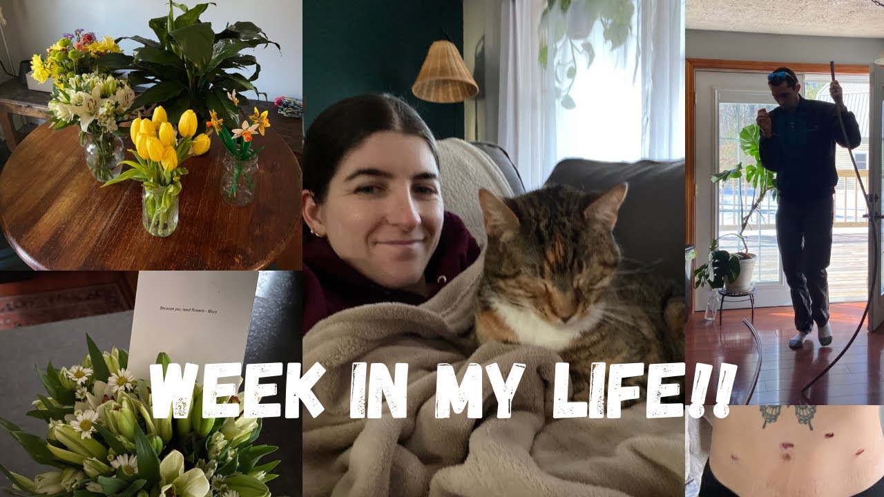 Vlog - Getting a Hysterectomy at 25, Surgery Recovery, and my Healing Process!! (Hour Long)