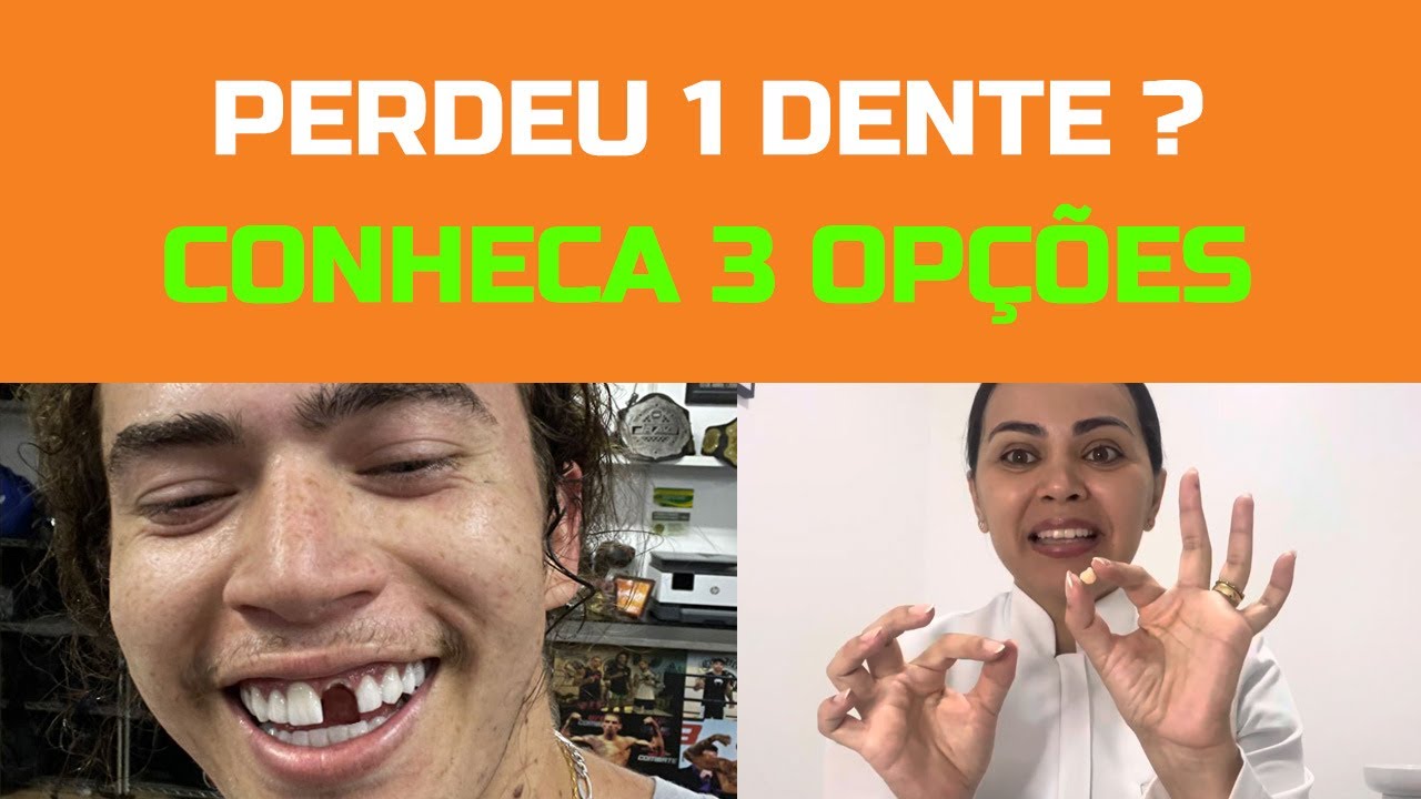 3 opções de prótese para quem perdeu um dente