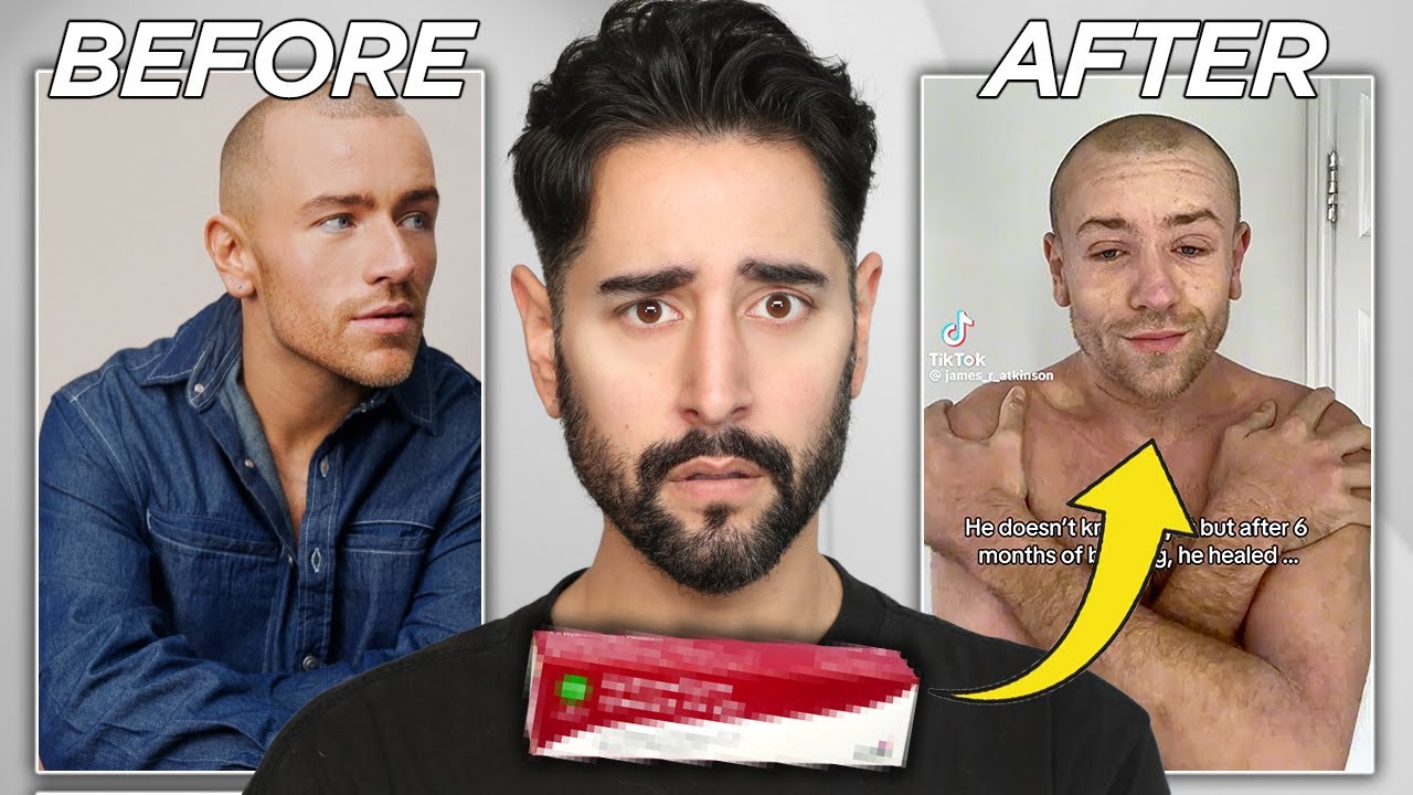 The Skin Condition That Doesn&rsquo;t Exist... But Everyone Could Suffer From - When Beauty Turns Ugly