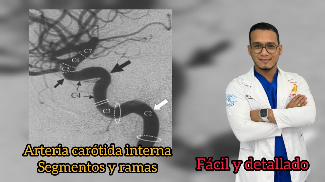 ARTERIA CARÓTIDA INTERNA. SEGMENTOS Y RAMAS. NEUROFACIL.