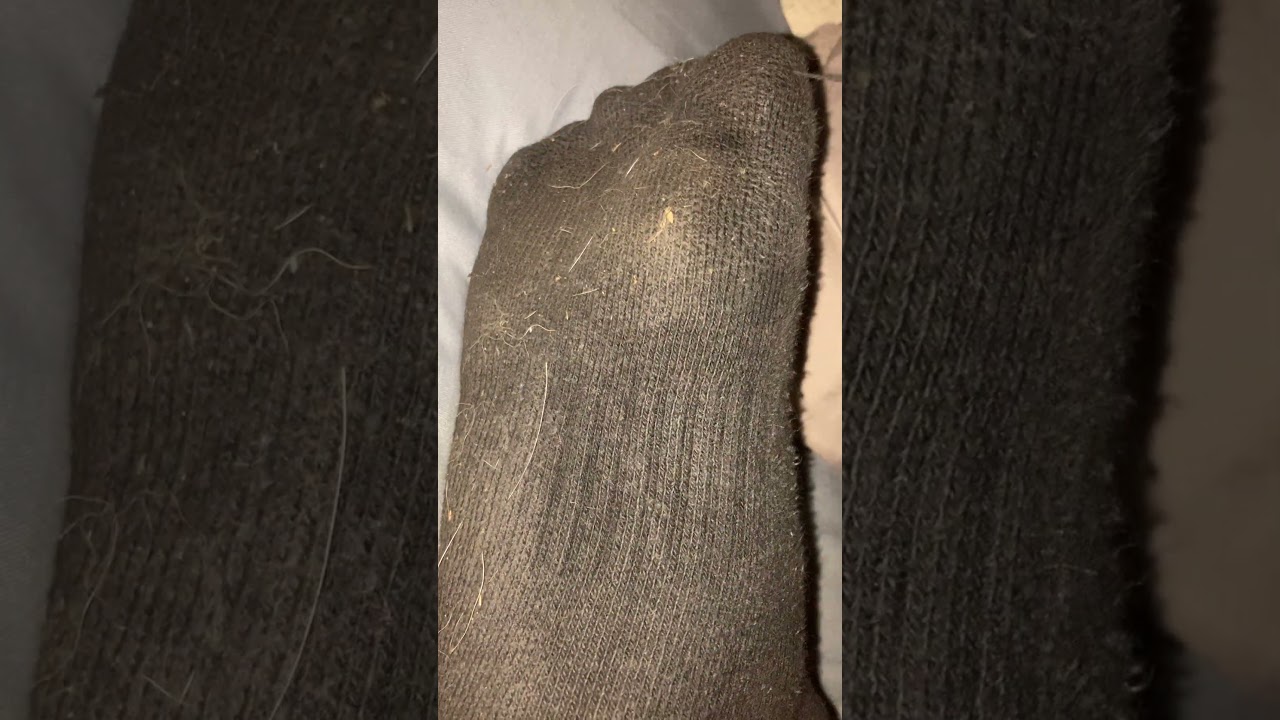 Sweaty sock removal 