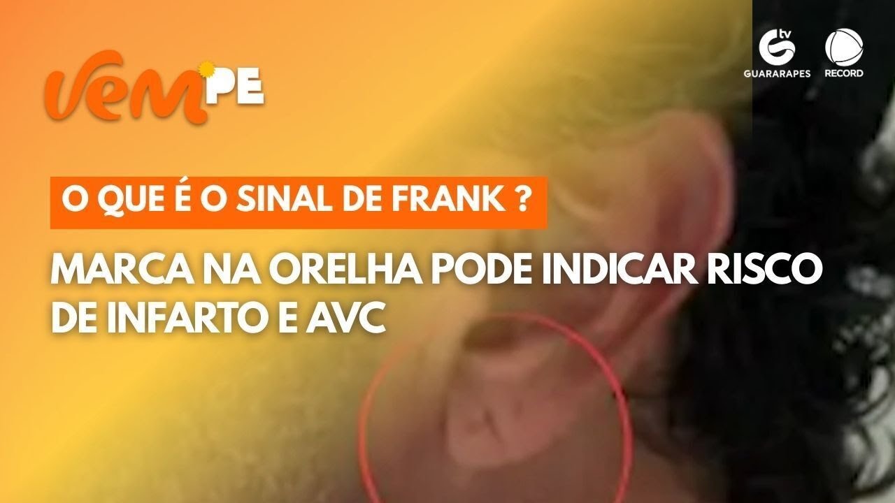 Marca na orelha pode indicar risco de infarto e AVC